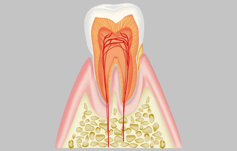 歯肉炎（初期段階）の症状と特徴
